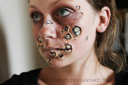 Trypophobia Zombie.