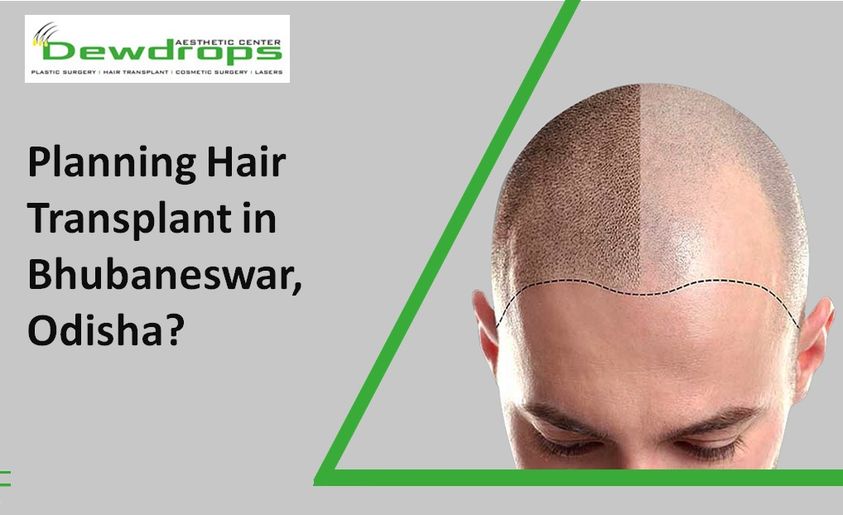 Best Hair Transplant in Bhubaneswar, Odisha by SurgeonOD on DeviantArt Best Hair Transplant in Bhubaneswar, Odisha by SurgeonOD on DeviantArt