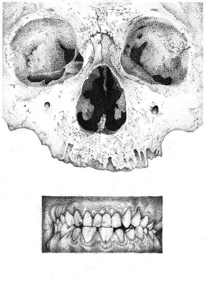Skull And Teeth