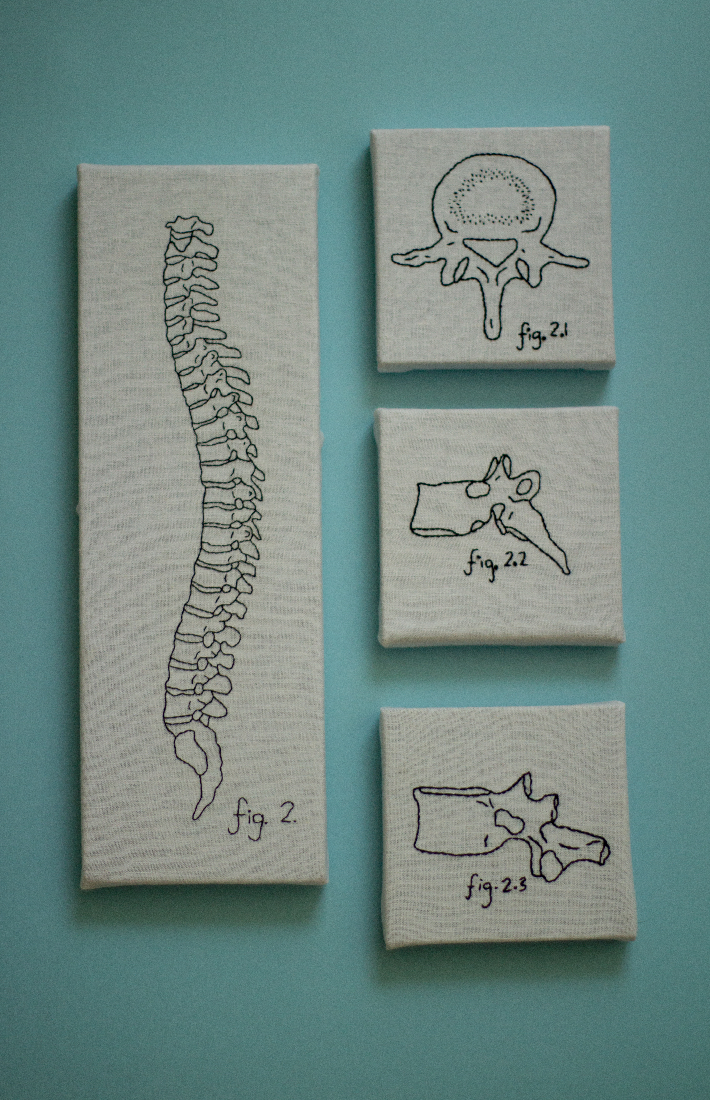 Spine and Vertebrae Group