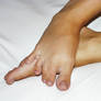 Webbed Toes II