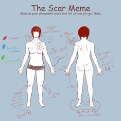 My Scars (The Scar Meme)