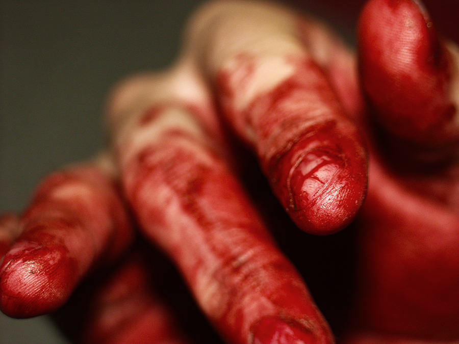 bloody fingers