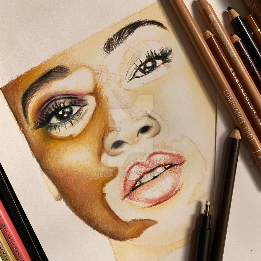 vitiligo drawing by Camelia07 on DeviantArt