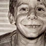 Loose Tooth
