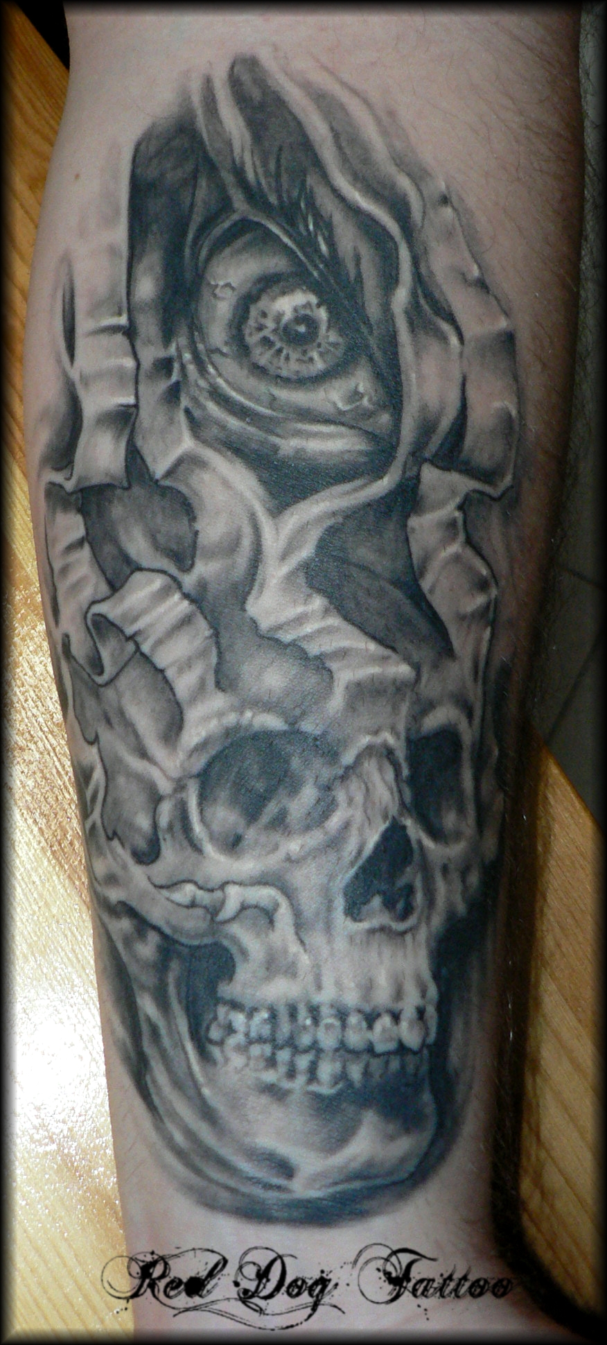 Barries Skull Healed