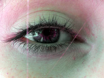 My Eye 2