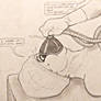 Ms Robinson's Ingrown Toenail Procedure 2