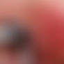 Macro nipple piercing
