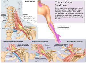 Neuropax Clinic