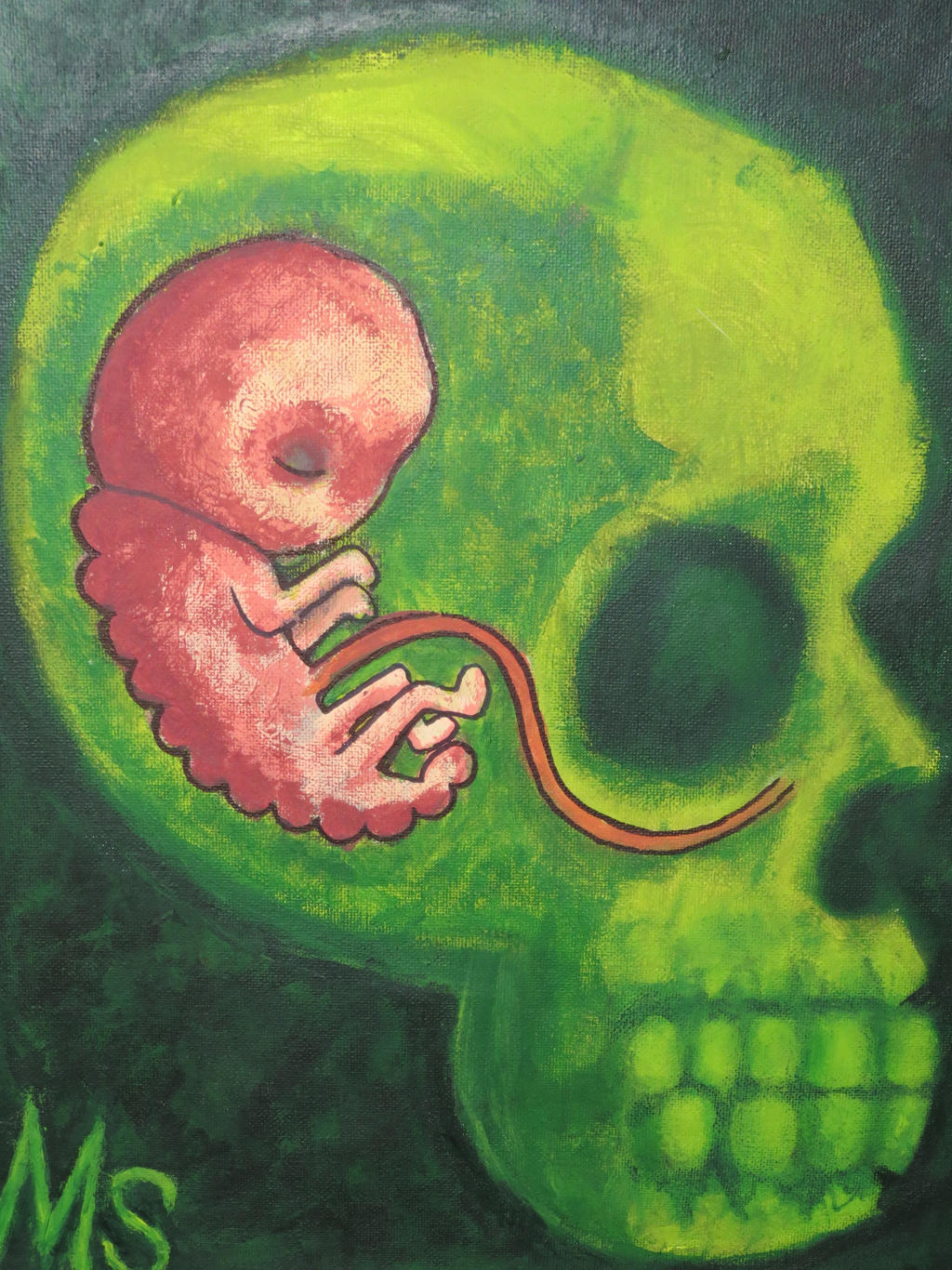 Fetus Skull