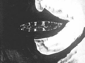 Teeth and Lips