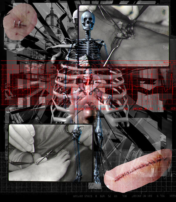 Frankenstien