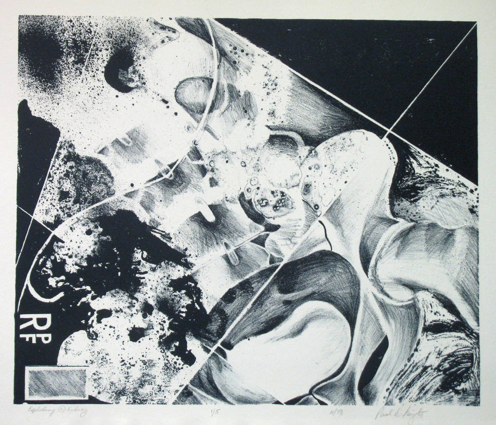 Exploding Left Kidney by pfeight Exploding Left Kidney by pfeight