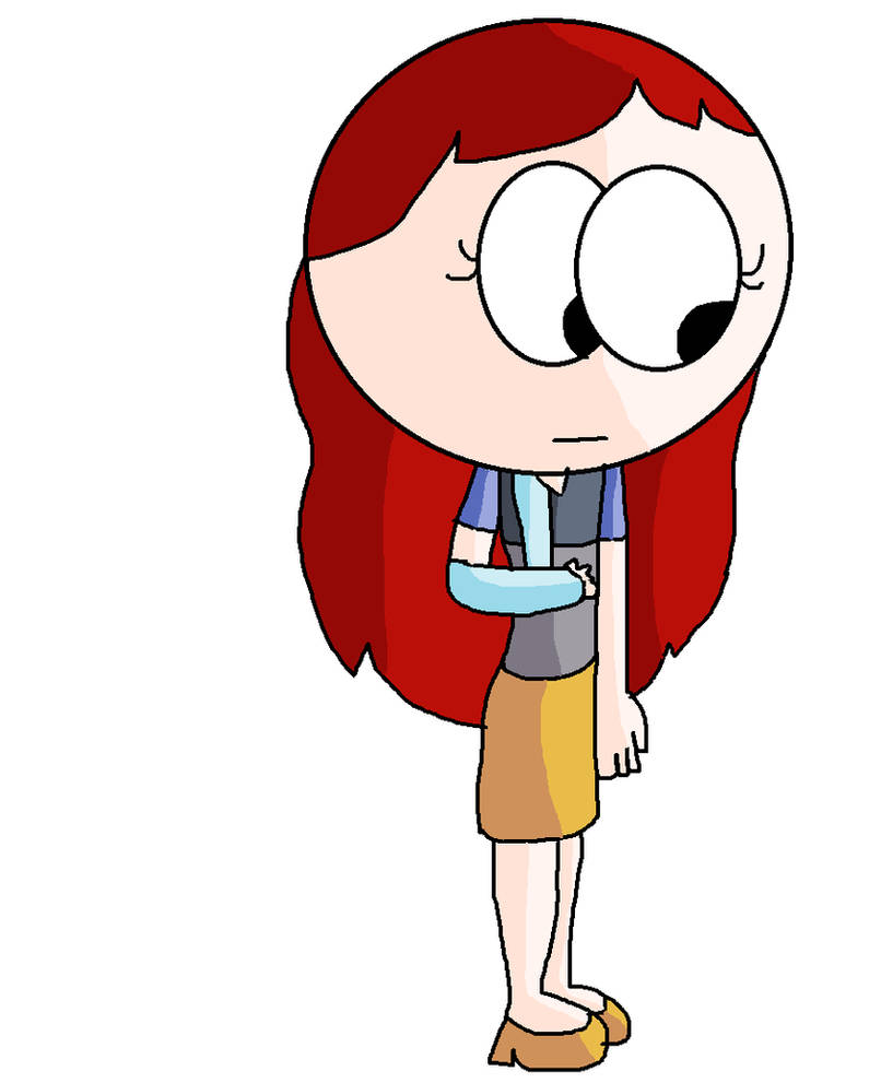 Broken Slashed Arm by Lydiathecrystalgem on DeviantArt