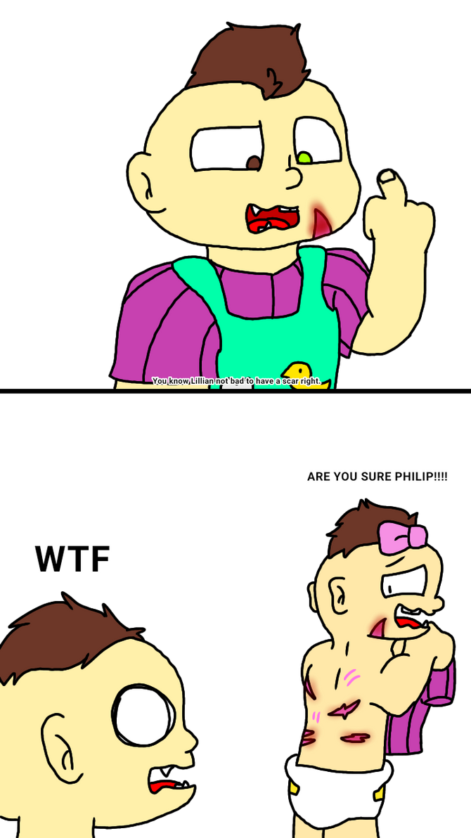 Scars (a mini rugrats comic) by andreeamariaduminica on DeviantArt
