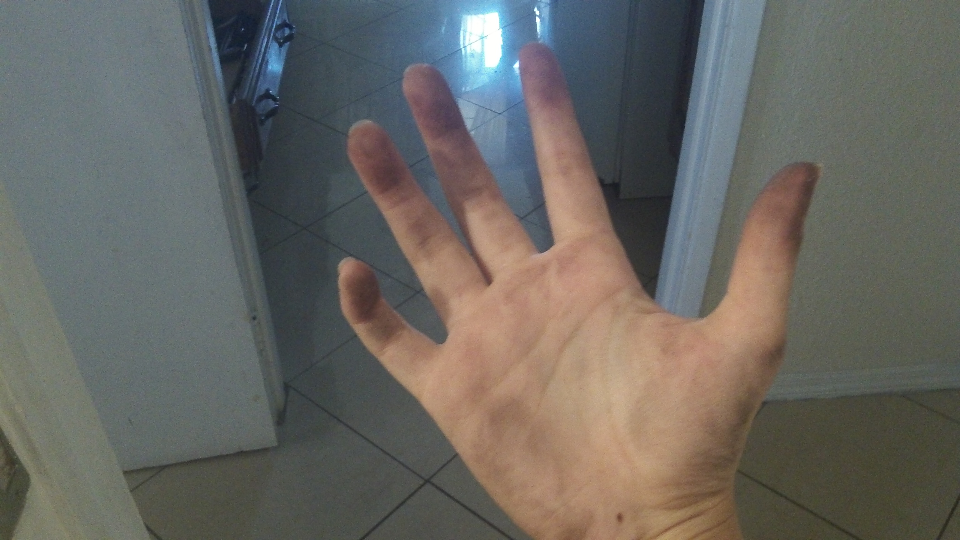 YOU GUYS LIKE MY HAND?