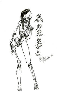 Anorexia