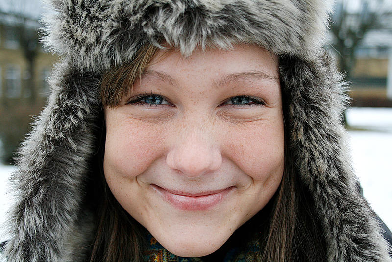 that hat those freckles