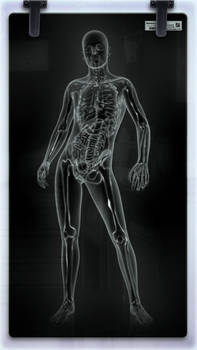 X-ray