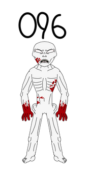 Scp 096