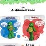 Turtle Tots React - Skinned knee