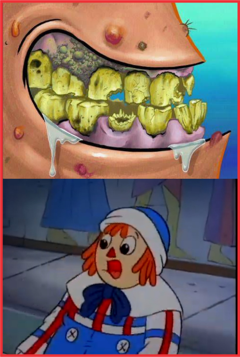 Patrick 2 Tooth Raggedy Andy's Reaction At Patrick's Teeth by SugarMuffin2002 on DeviantArt
