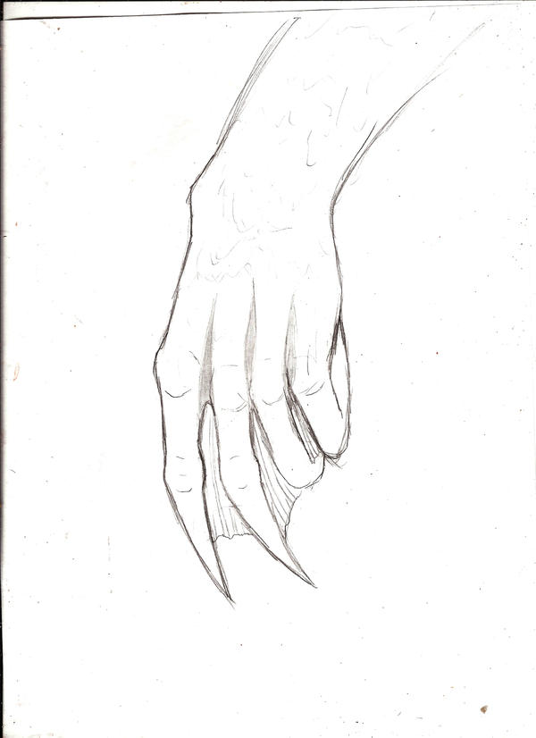 luc's hand stage 1