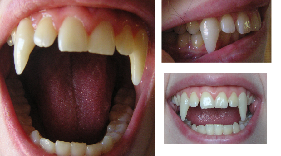 Fangs With Color seen my Fangs? by Tropicanine on DeviantArt