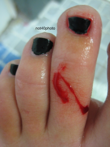 Toe Bleed 07