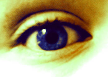 Eye 6