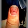 Thumbbert