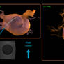 Catheter Simulation