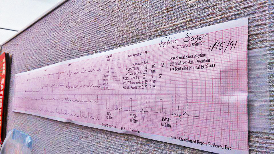 My EKG