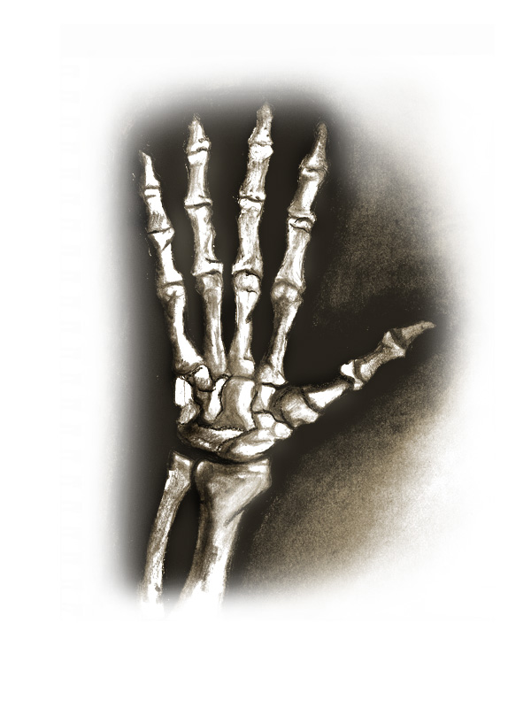 Boney Hand