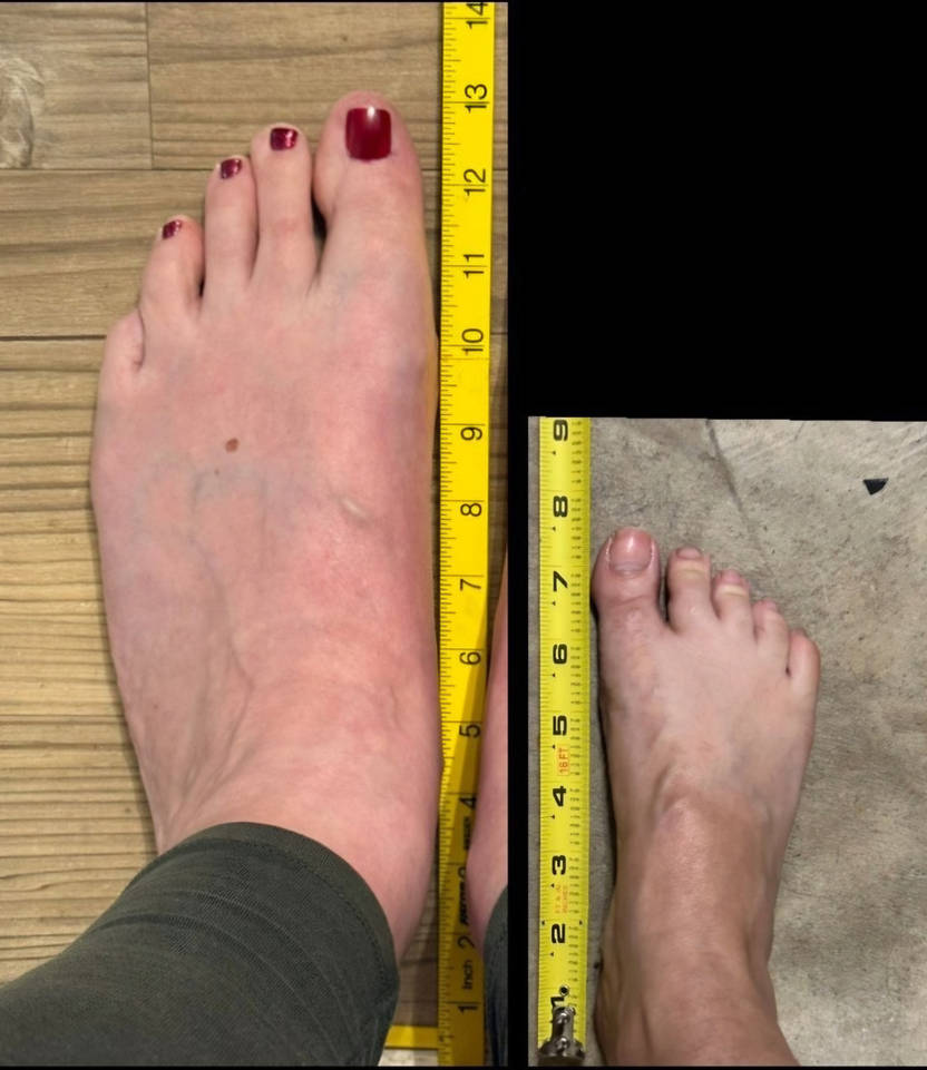 foot comparison measurement size 18 versus size 2 by stevensjeremiah54 ...
