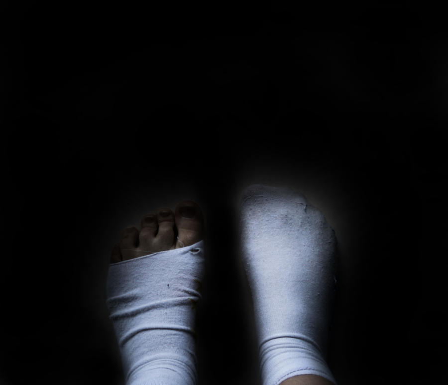 Tatteredness Tattered Feet by emlemma on DeviantArt