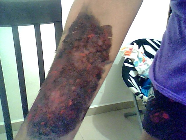 Carbonized Arm