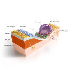 Bone remodelling