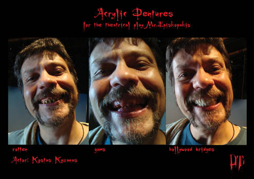 acrylic dentures