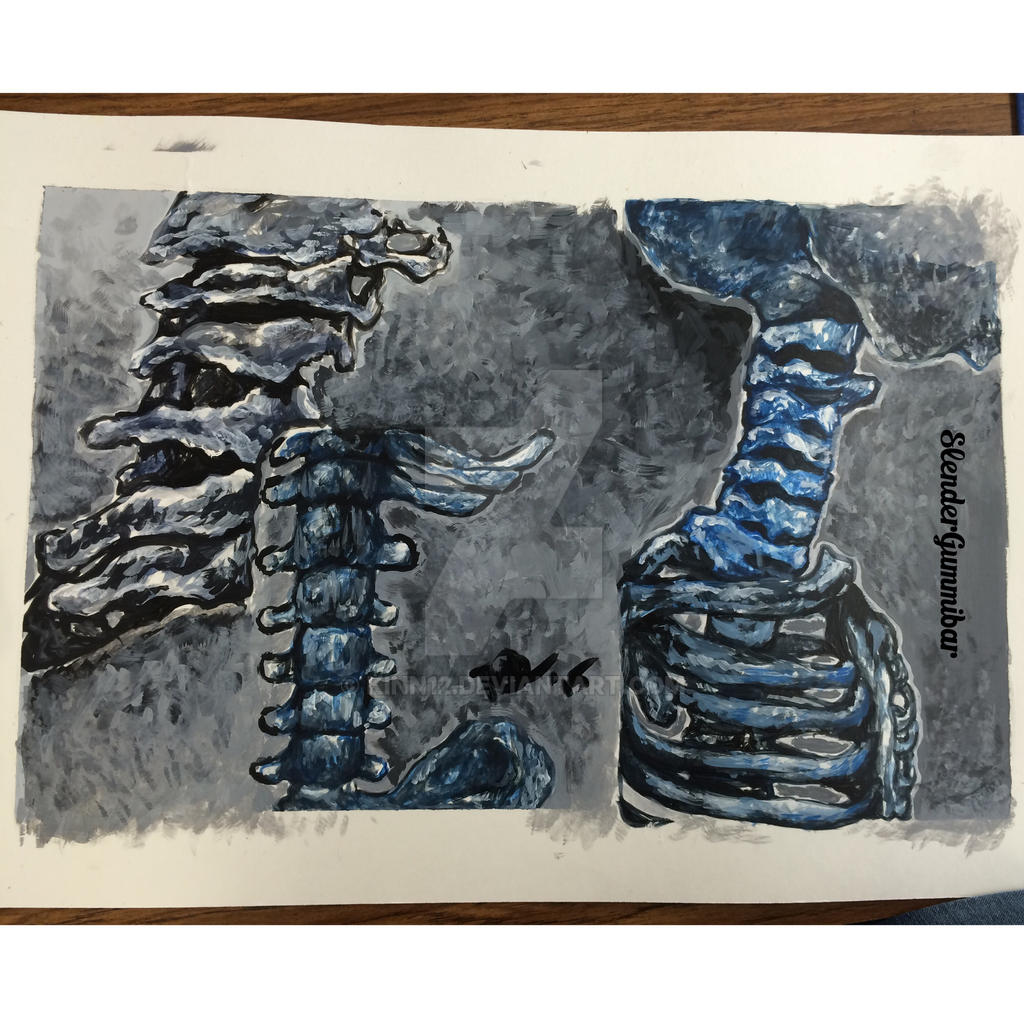 Blue Bones by kinn12 on DeviantArt