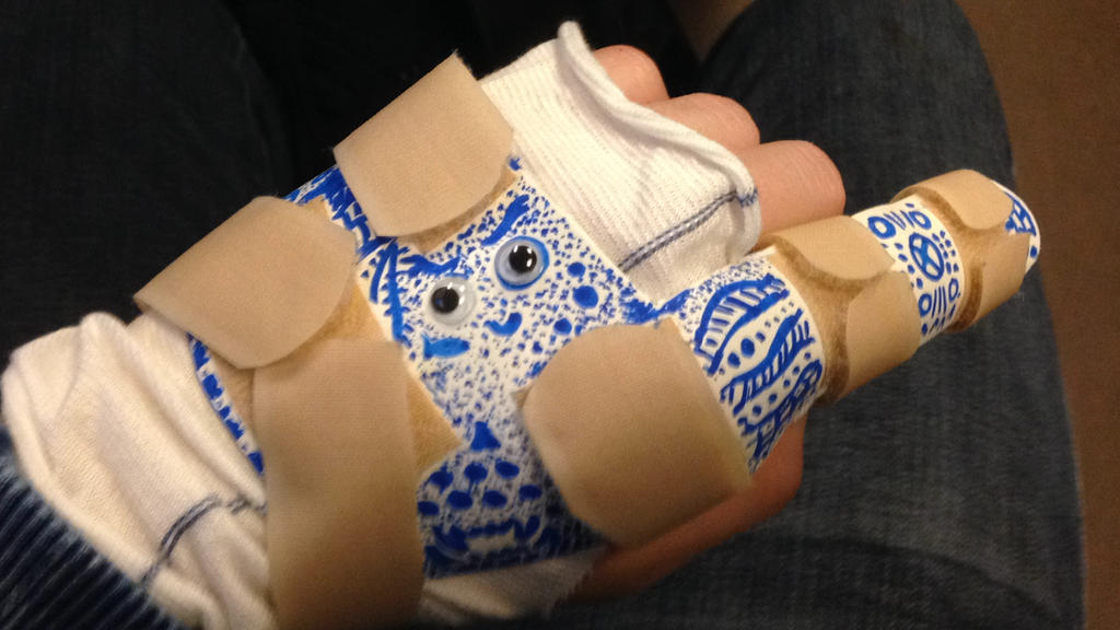 Fun Splinting Splint Doodles by Ionbom on DeviantArt