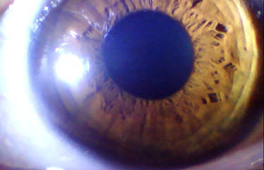 My Eye