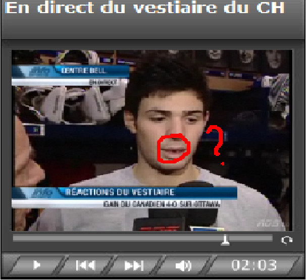 La dent de Carey Price