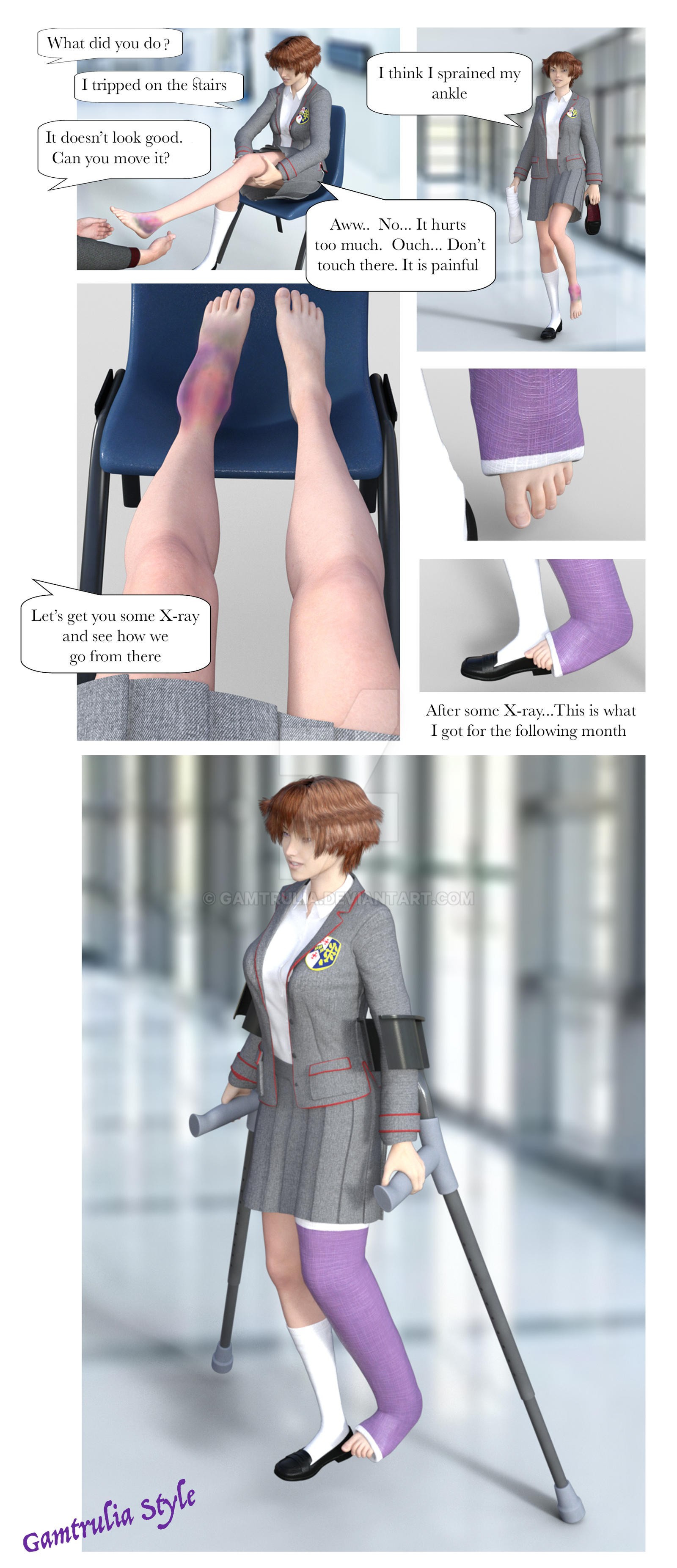 I Think I Sprained My Ankle By Gamtrulia On DeviantArt i-think-i-sprained-my-ankle-by-gamtrulia-on-deviantart