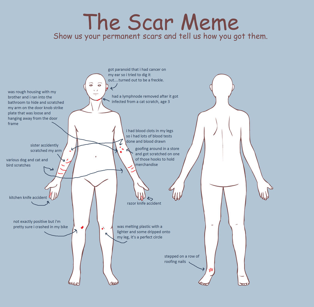 scar meme by on DeviantArt