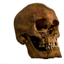 Skull of Richard III University of Leicester Trans