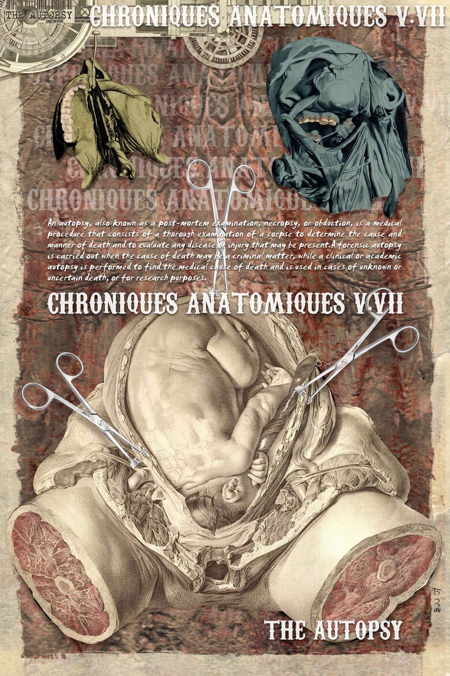 Chroniques Anatomiques V.VII