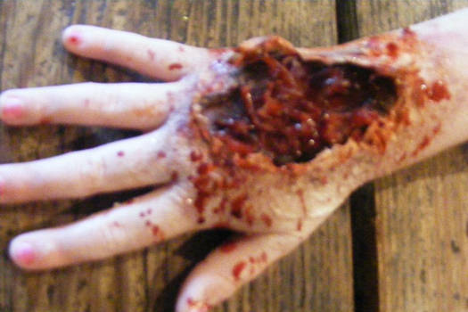 Sfx Wound