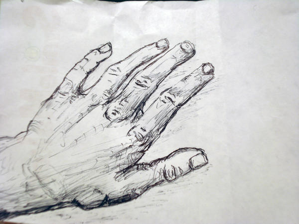 battered hand by piesandcheese on DeviantArt